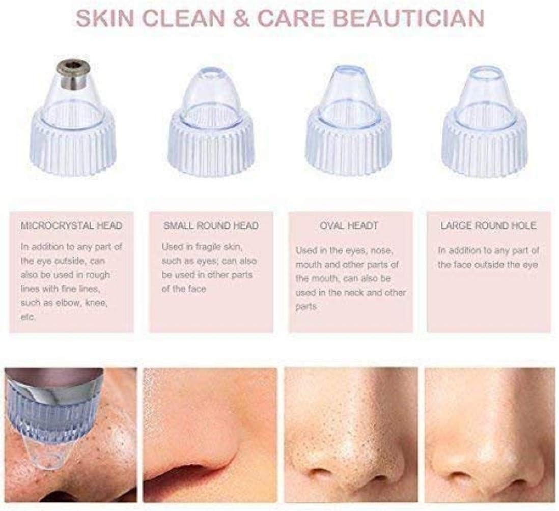 Pore Vacuum Blackhead Remover – Deep Clean for Radiant Skin