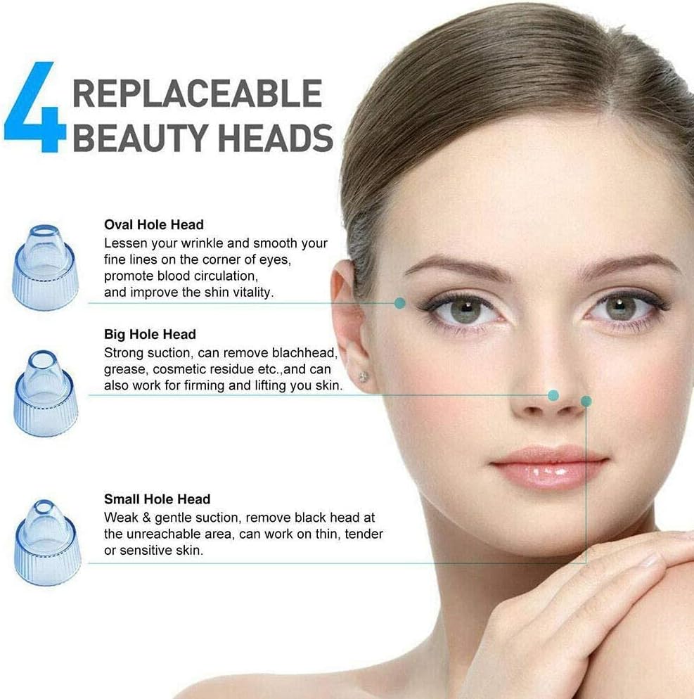 Pore Vacuum Blackhead Remover – Deep Clean for Radiant Skin